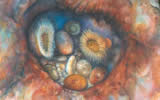 Anemone Hole